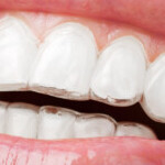 Group logo of Risks, Costs, and Benefits of Dental Implants, Teeth Straightening, and Jaw Surgery